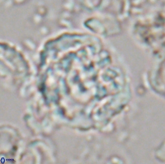Cervisiella operculata 21820