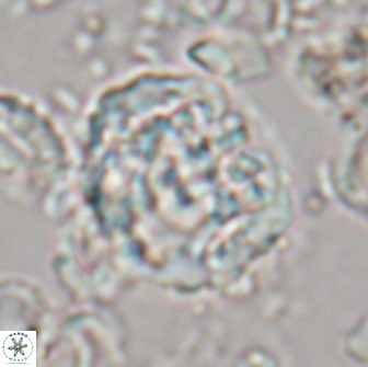 Cervisiella operculata 21820