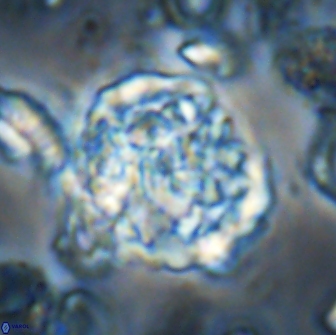 Cervisiella operculata 21821