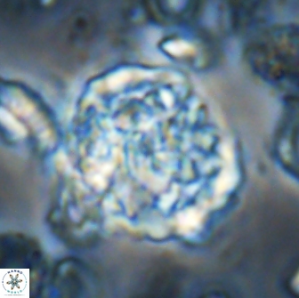 Cervisiella operculata 21821