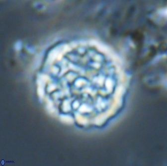 Cervisiella operculata 21984