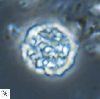 Cervisiella operculata 21984