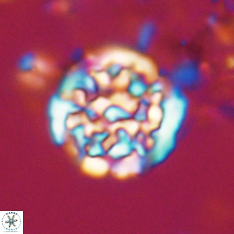 Cervisiella operculata 21981