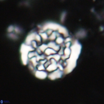 Cervisiella operculata 21982