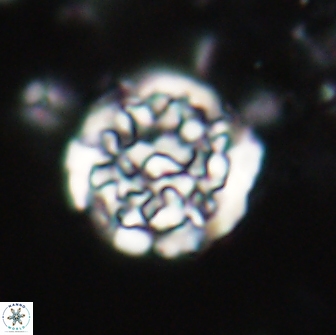 Cervisiella operculata 21982