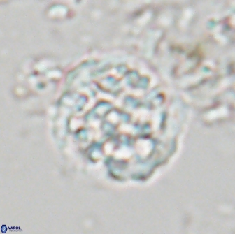 Cervisiella operculata 21983