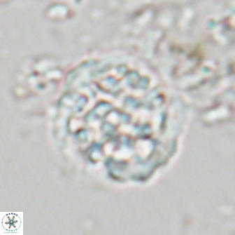 Cervisiella operculata 21983