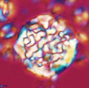 Cervisiella operculata 23198