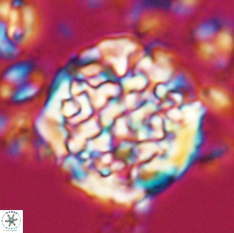 Cervisiella operculata 23198