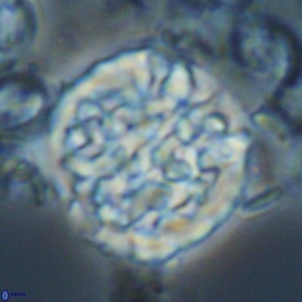Cervisiella operculata 23200