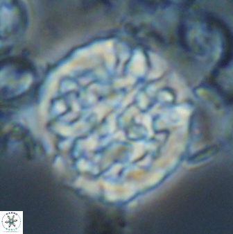 Cervisiella operculata 23200