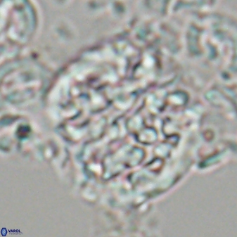 Cervisiella operculata 23201