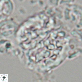 Cervisiella operculata 23201