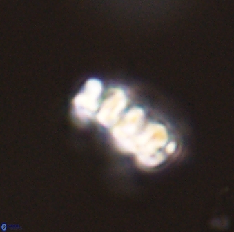 Cervisiella operculata 43848