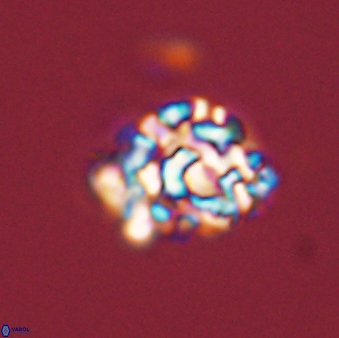 Cervisiella operculata 43855