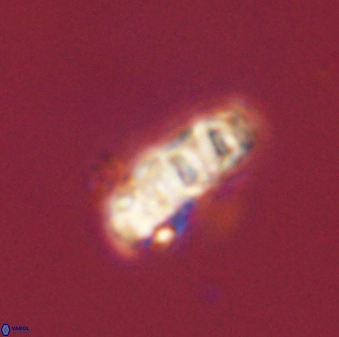 Cervisiella operculata 43851