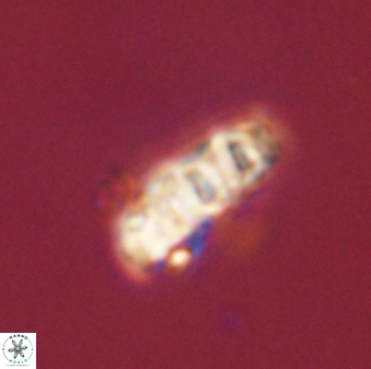 Cervisiella operculata 43851