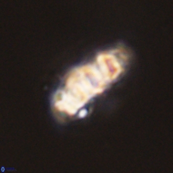 Cervisiella operculata 43852