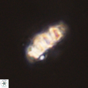 Cervisiella operculata 43852