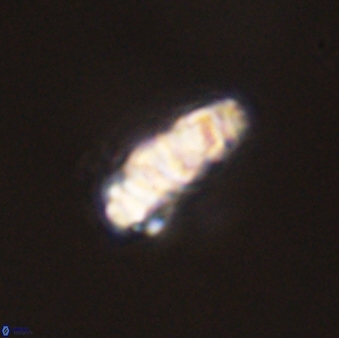 Cervisiella operculata 43853