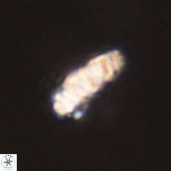 Cervisiella operculata 43853