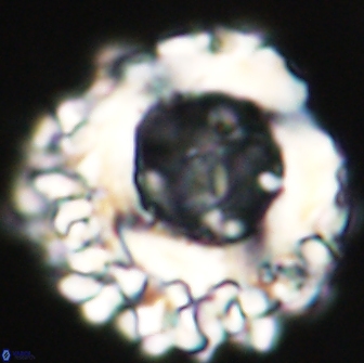 Cervisiella polymegalo 64879