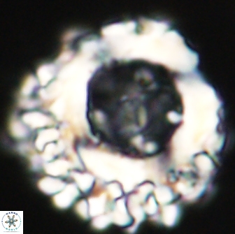 Cervisiella polymegalo 64879