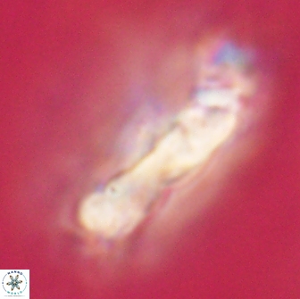 Cervisiella polymegalo 64884