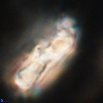 Cervisiella polymegalo 64885