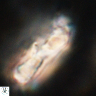 Cervisiella polymegalo 64885