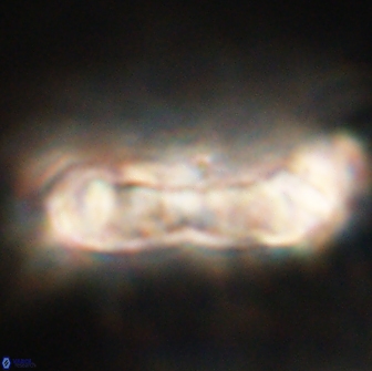 Cervisiella polymegalo 64886