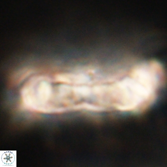 Cervisiella polymegalo 64886