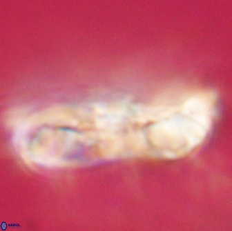 Cervisiella polymegalo 64887