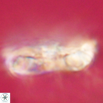 Cervisiella polymegalo 64887