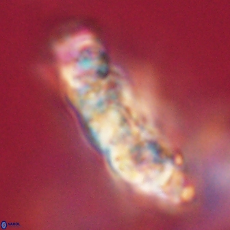 Cervisiella polymegalo 64888