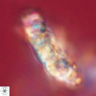 Cervisiella polymegalo 64888