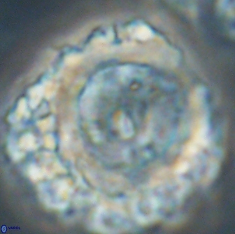 Cervisiella polymegalo 64882