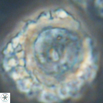Cervisiella polymegalo 64882