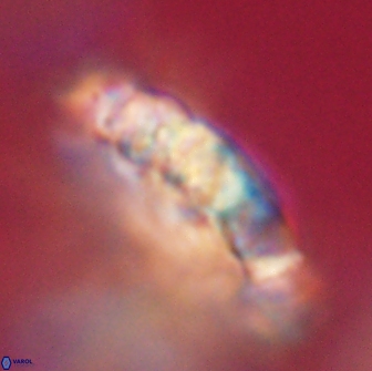 Cervisiella polymegalo 64895