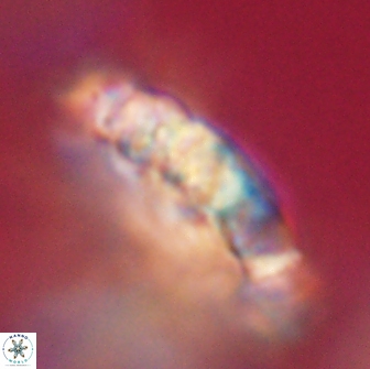 Cervisiella polymegalo 64895