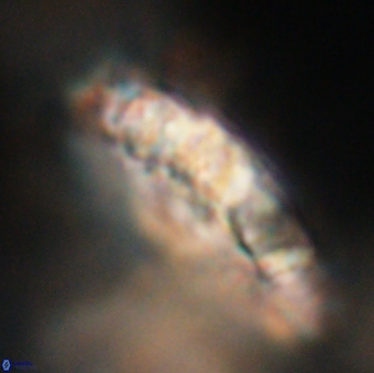Cervisiella polymegalo 64896
