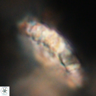 Cervisiella polymegalo 64896