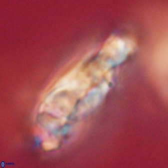 Cervisiella polymegalo 64898
