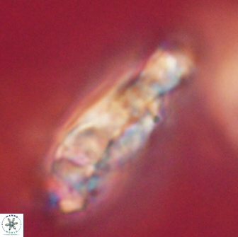 Cervisiella polymegalo 64898