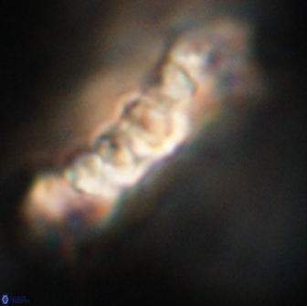 Cervisiella polymegalo 64890