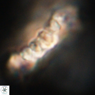Cervisiella polymegalo 64890
