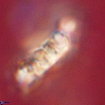 Cervisiella polymegalo 64891