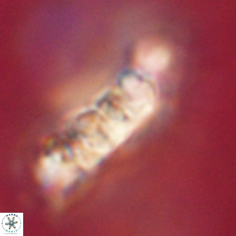 Cervisiella polymegalo 64891