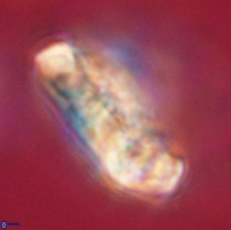 Cervisiella polymegalo 64892