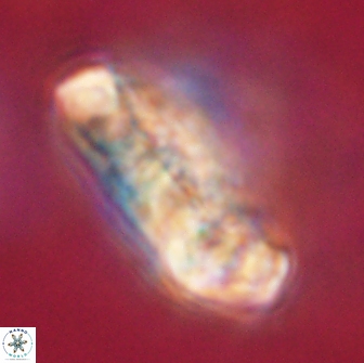 Cervisiella polymegalo 64892